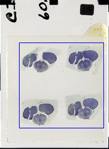 Media type: image; Special Collections 3298   shows specimen_part histological serial section;